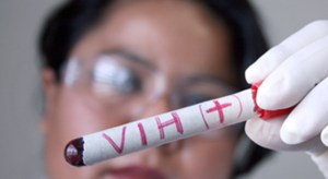 Denuncian ausencia de reactivos para el control del VIH