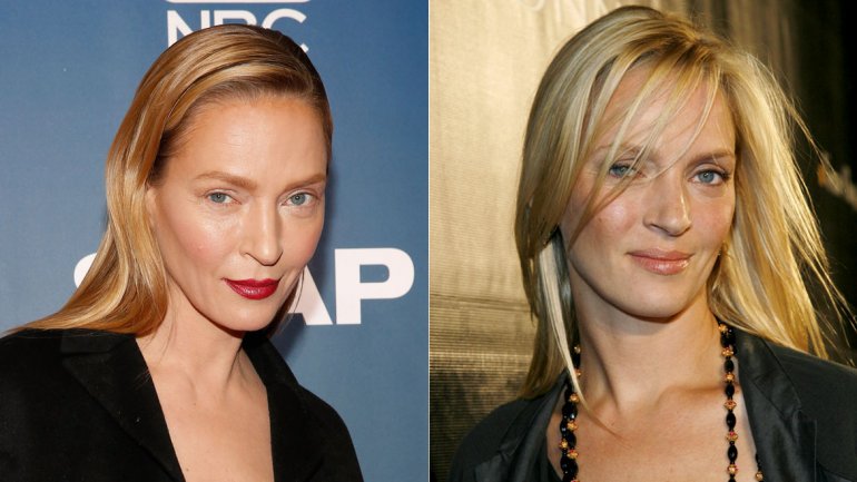 ¿Qué se hizo Uma Thurman en el rostro?