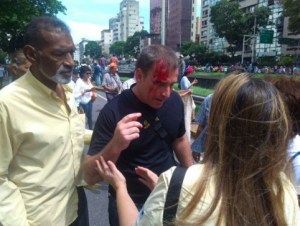 Hieren a manifestante en la Libertador al lanzarle objeto contundente desde edificios de la Gmvv (Foto)
