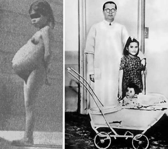 Lina Medina, la niña que fue madre con tan solo cinco años (Fotos)