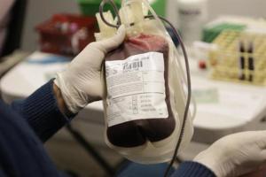 Transfusiones de sangre producen mejoras en pacientes con alzheimer