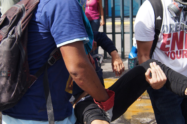 Reportan un afectado por inhalación de gases lacrimógenos en Las Mercedes. Foto: Gabriela Gómez / LaPatilla.com