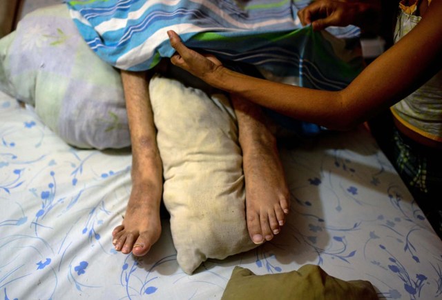 Ana Barrios, takes care of her quadriplegic husband Marco Guillen, at their house in Barquisimeto, Lara state, Venezuela on October 23, 2017. Marco Guillen became quadriplegic in an accident twelve years ago, amid Venezuela's deep economical crisis he desperately asks President Maduro's government to help him to live with dignity, meeting his medical necessities otherwise he pleads for euthanasia. / AFP PHOTO / FEDERICO PARRA / TO GO WITH AFP STORY by MARGIONI BERMUDEZ