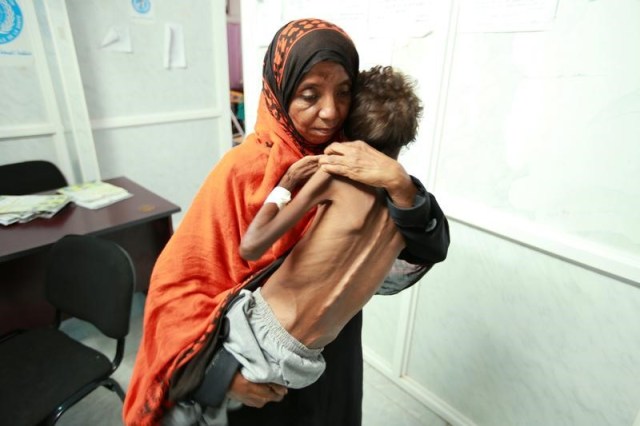 Una mujer sostiene a su hijo Imran Faraj, de 8 años, quien sufre de desnutrición en un hospital de la ciudad portuaria de Al Hudayda, 13 de junio, 2017. REUTERS/Abduljabbar Zeyad