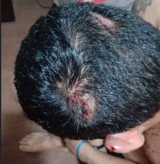 Radiólogo carabobeño fue brutalmente golpeado en Arequipa, Perú (fotos y video)