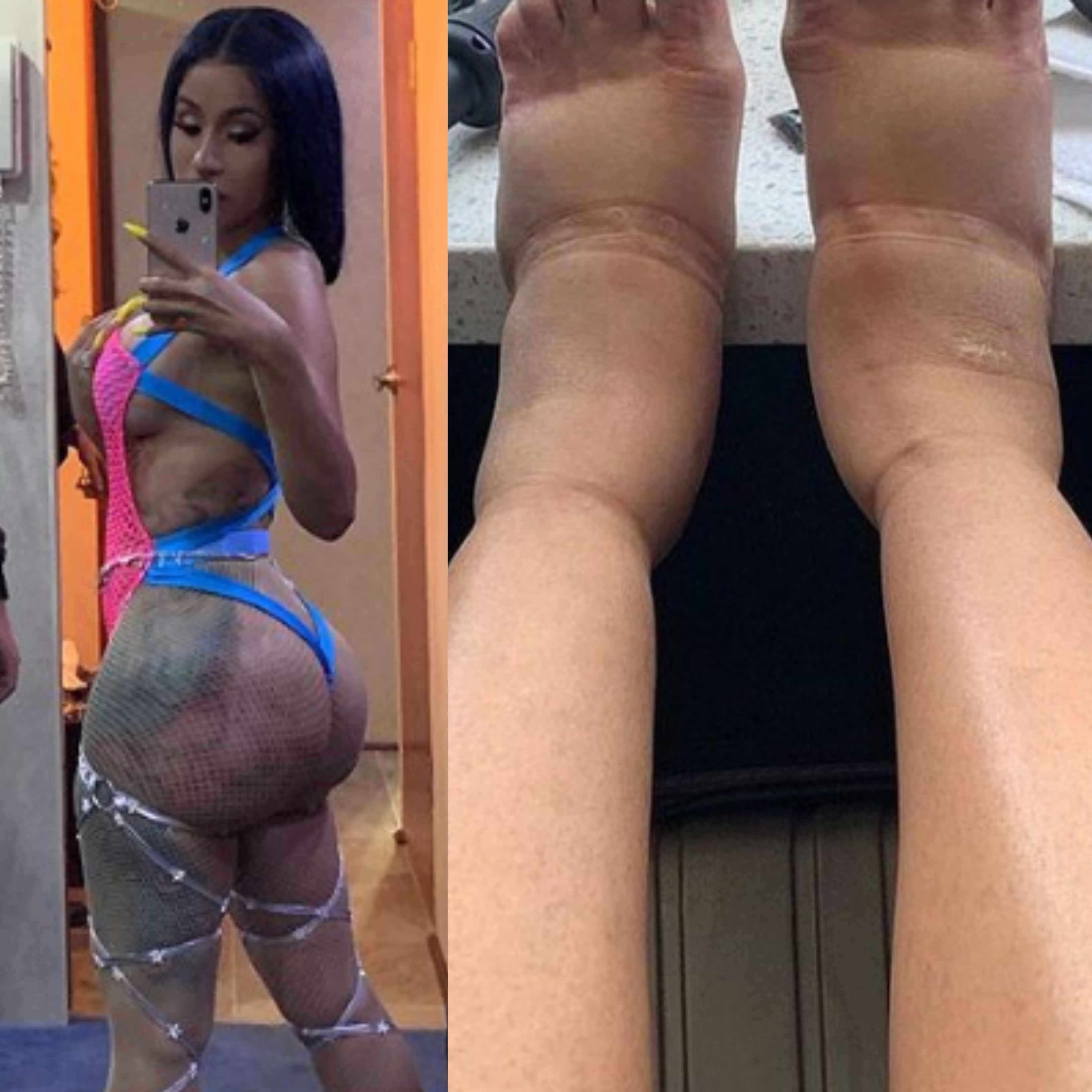 Si te gustan las nalgas de Cardi B espera ver sus horrorosos pies (FOTOS)