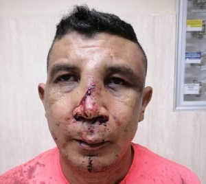Polinacionales le dieron una paliza a un sargento de la aviación en Aragua