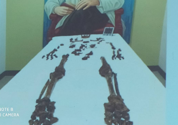 Los impactantes hallazgos tras exhumación de los restos del Dr. José Gregorio Hernández (FOTOS)