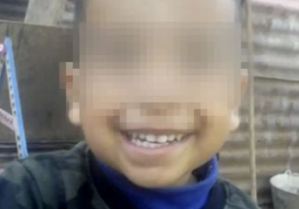 Un pitbull destrozó el rostro de un niño de tres años en Argentina