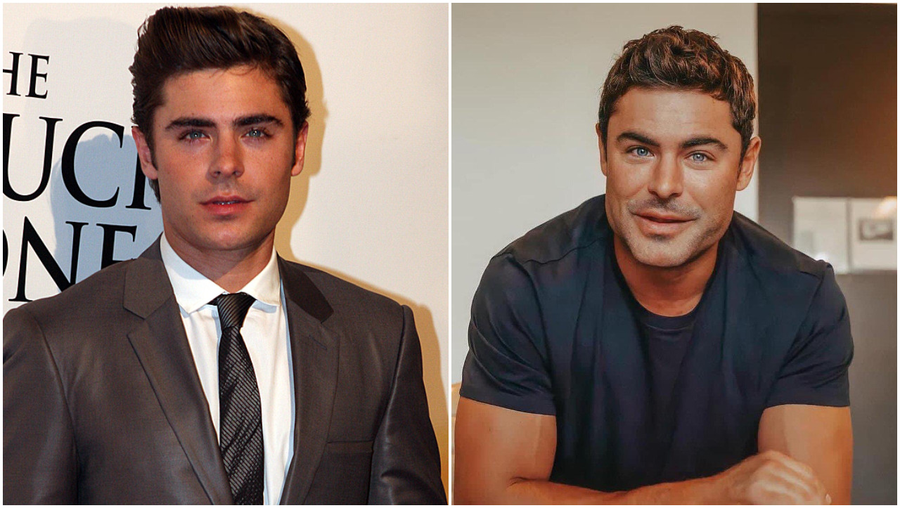 Cirujano explicó qué le habría ocurrido a Zac Efron en el rostro