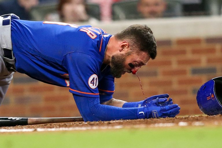 Así le quedó el rostro a Kevin Pillar tras recibir un pelotazo a más de 150 kilómetros por hora en la MLB (FOTO)