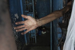 Lara es la entidad donde mueren más presos por tuberculosis y desnutrición