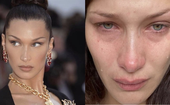 Las delicadas imágenes que mostró Bella Hadid para revelar el daño que le han hecho las redes sociales