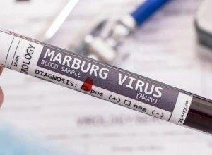 La OMS aseguró que avanzan los preparativos de ensayos de vacunas contra el virus de Marburgo