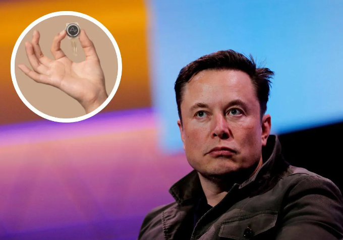 Musk afirma que Neuralink ya está lista para hacer un segundo implante de chip cerebral